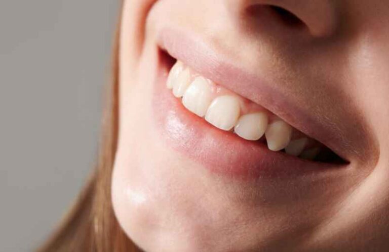 Souriez en toute confiance : Comment avoir les dents blanches naturellement