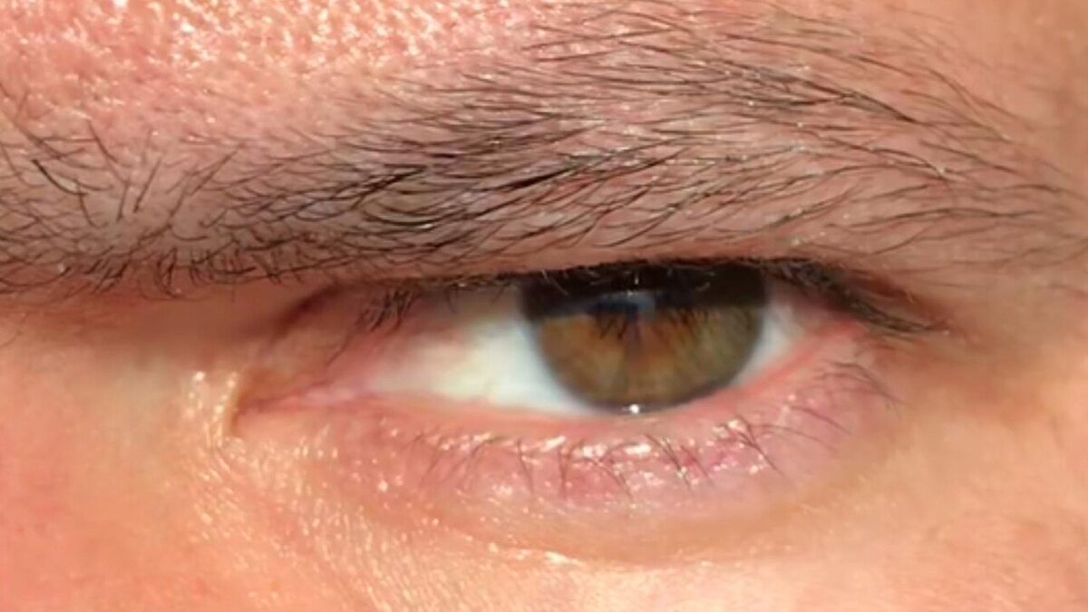 yeux noisette lumineux